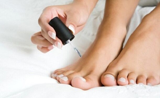Nail fungus treatment varnish
